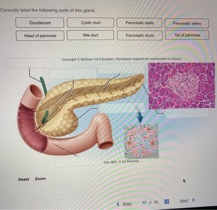 Correctly label the parts of the pancreas.