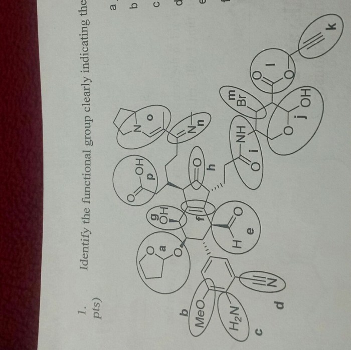 Identify the letter that is indicating the lumen.