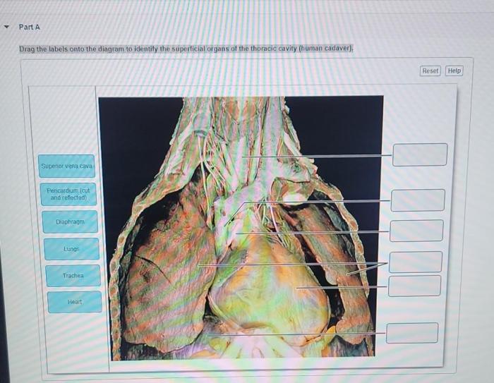 Drag the labels onto the diagram to identify the organs