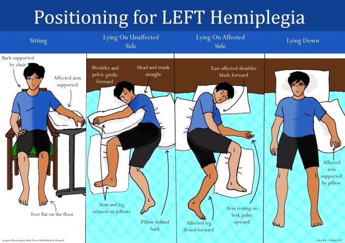 When positioning a hemiplegic patient in the supported fowler's